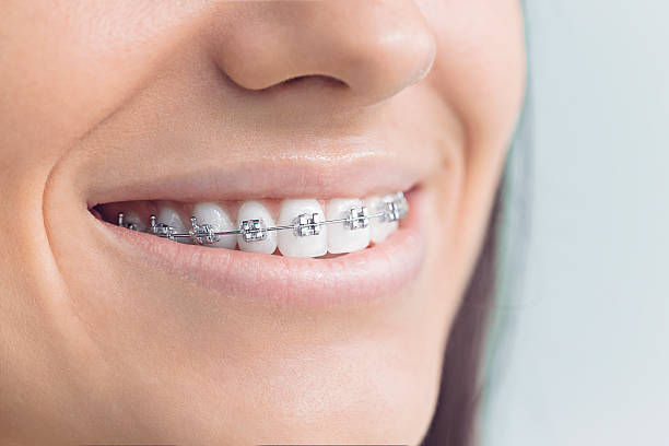 Best Teeth Whitening  in Chesterfield, IN